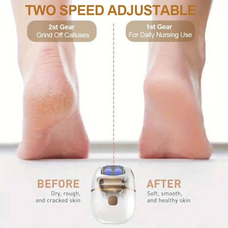 Electric Foot Grinder | Smooth & Soft Feet at Home | UAE COD